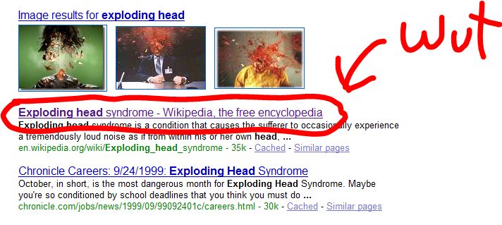 exploding head syndrome is real.JPG